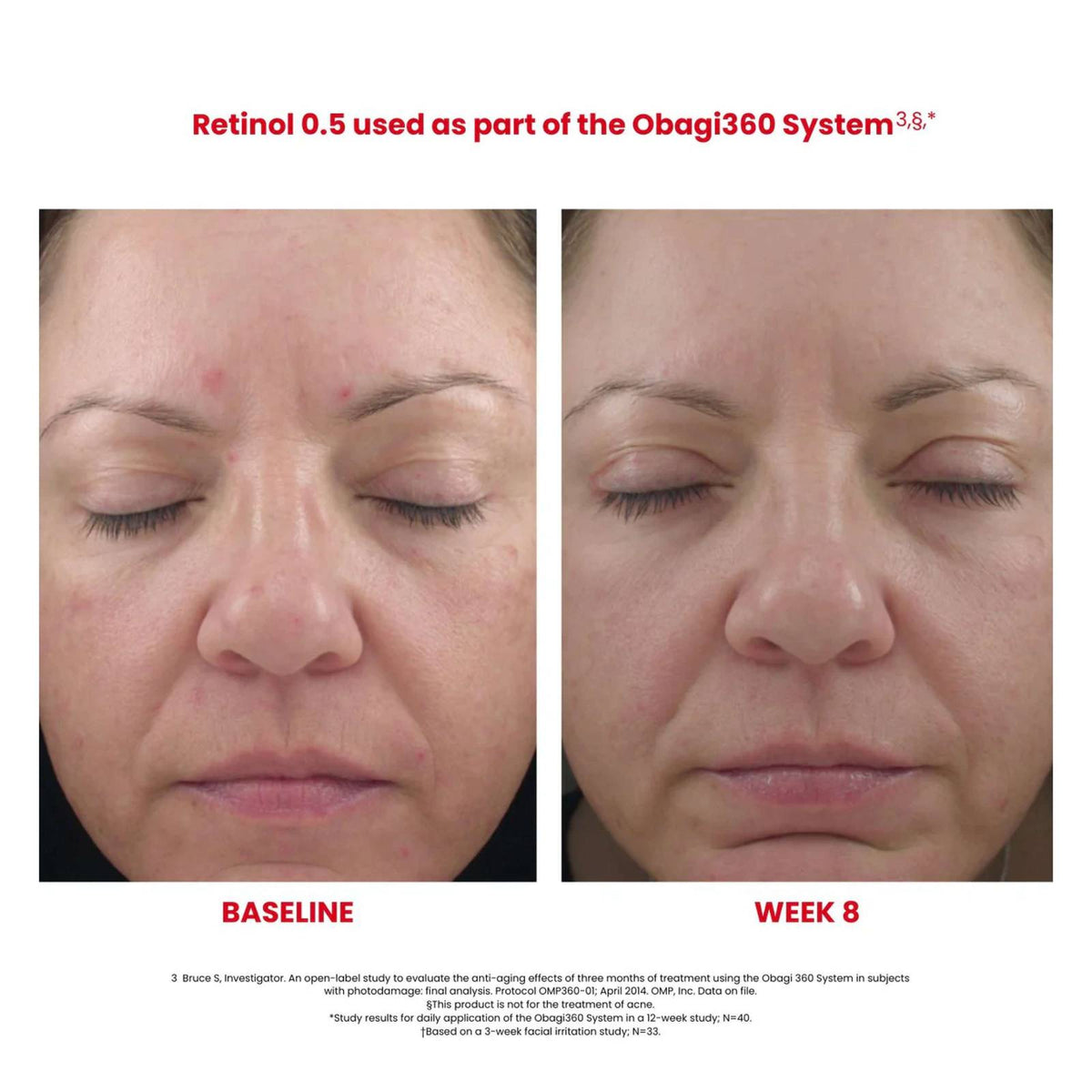 Obagi360® Smoothing Retinol 0.5