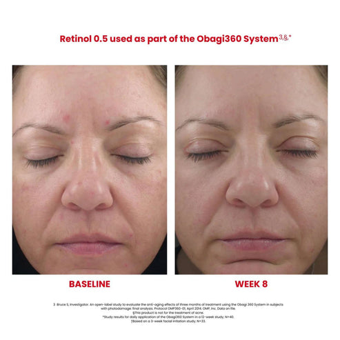 Obagi360® Smoothing Retinol 0.5