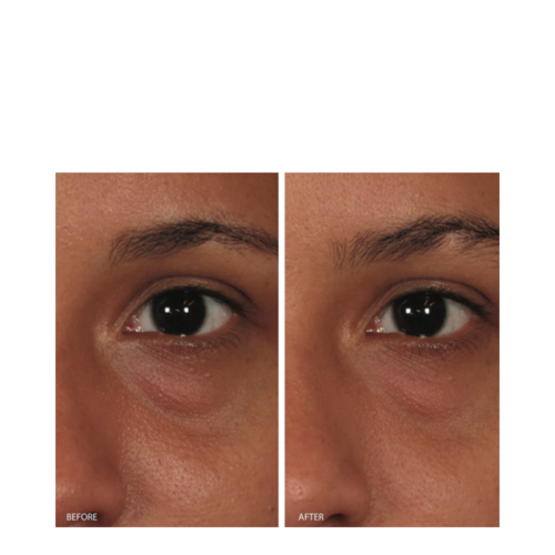 Imagen Skincare ORMEDIC Balancing Eye Lift Gel