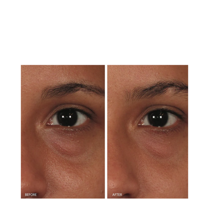 Image Skincare Ormedic Balancing Eye Lift Gel