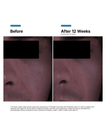 SkinCeuticals P-TIOX 霜的使用說明及逐步圖片