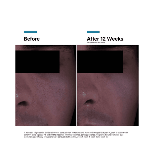 SkinCeuticals P-TIOX Cream