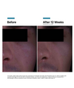 SkinCeuticals P-TIOX 霜的使用說明及逐步圖片