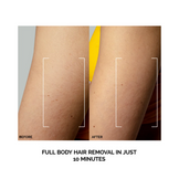 Foreo hårfjerningsenhet 1 stykke