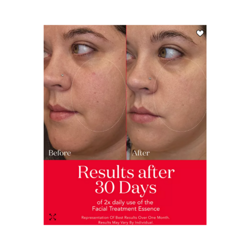 SK-II Pitera Anti Aging Set