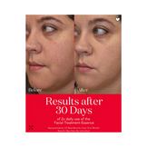 SK-II Pitera Anti Aging Set