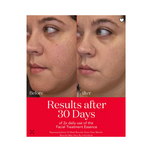 SK-II Pitera Anti Aging Set