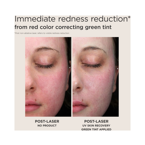 Before and after image showing EltaMD UV Skin Recovery SPF 50 visibly reduces redness on post-laser treated skin with green tint correction.