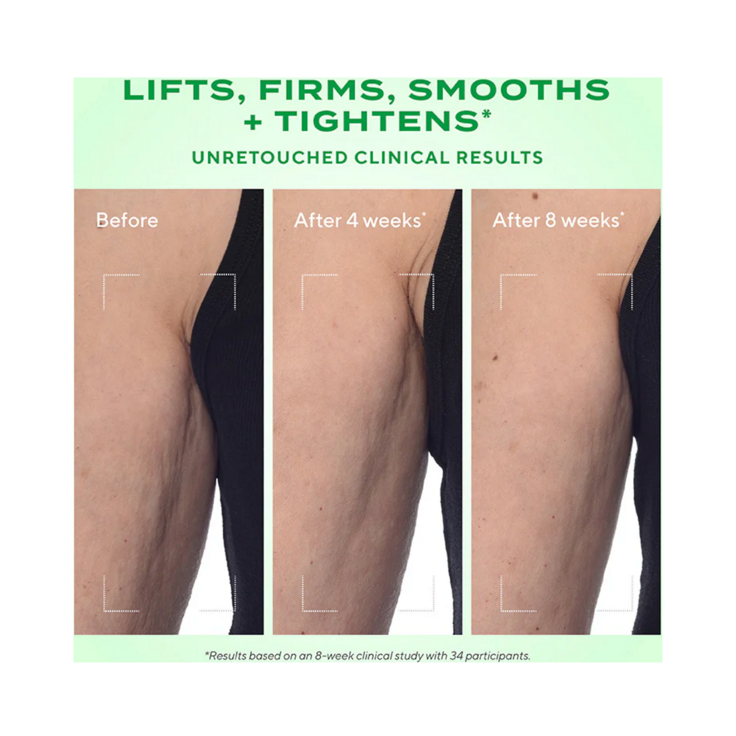 Before and after comparison of arm treated with Murad Retinal ReSculpt Body Treatment over 8 weeks, showing smoother, firmer skin.