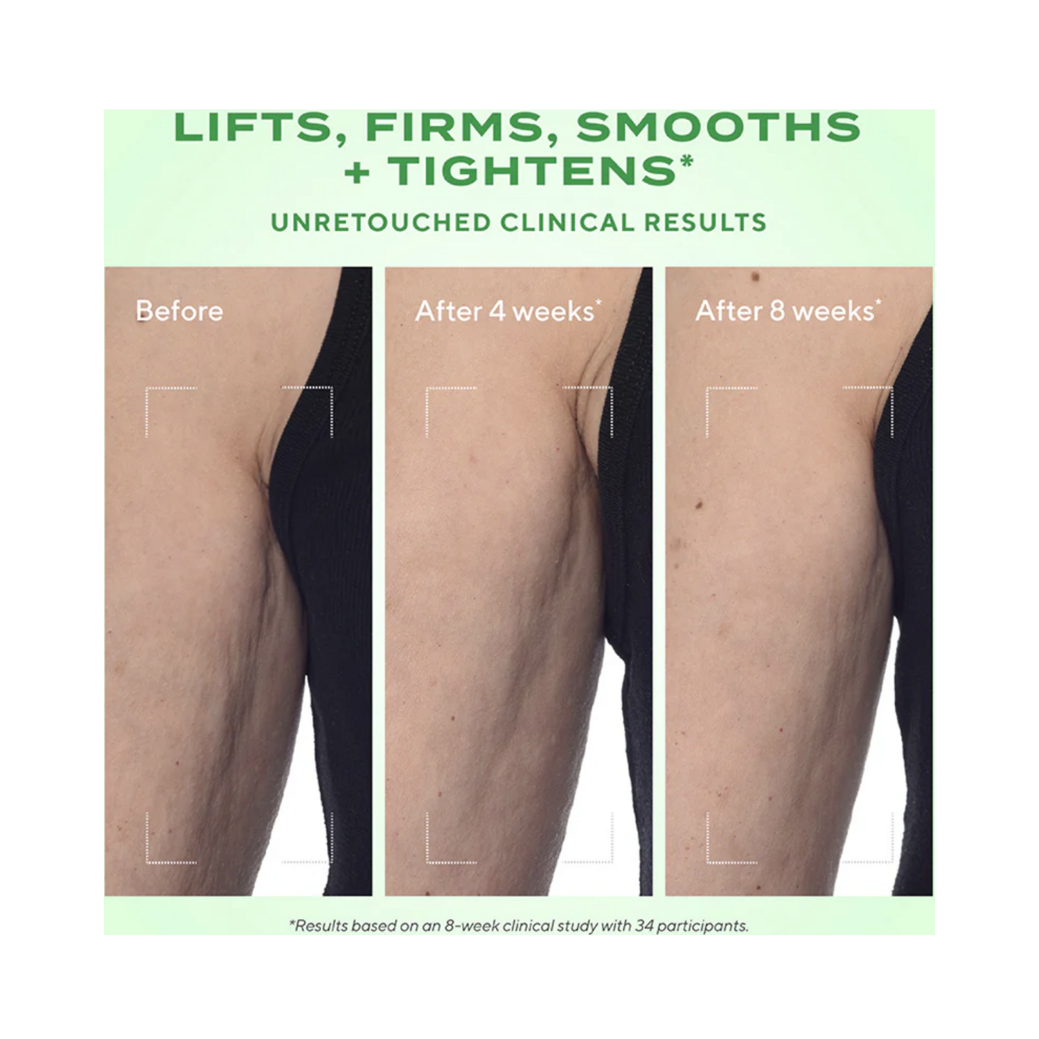 Before and after comparison of arm treated with Murad Retinal ReSculpt Body Treatment over 8 weeks, showing smoother, firmer skin.