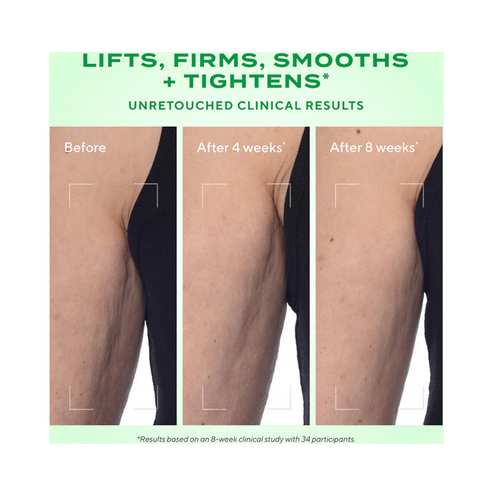 Before and after comparison of arm treated with Murad Retinal ReSculpt Body Treatment over 8 weeks, showing smoother, firmer skin.