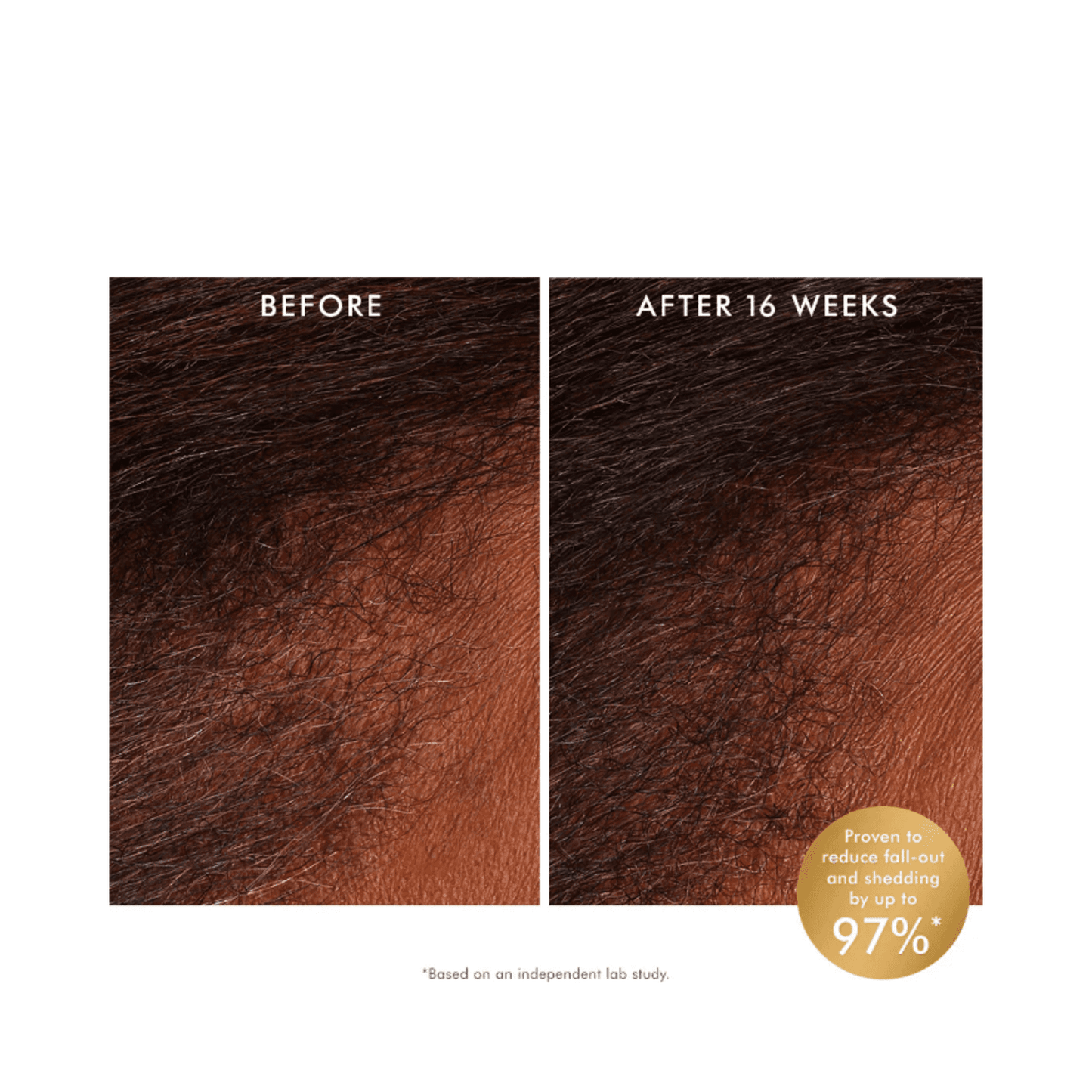 Side-by-side scalp comparison showing hair regrowth and less shedding after 16 weeks of Moroccanoil Scalp Tonic treatment.