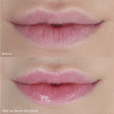 Revive7 Lip Serum
