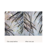 פילינג טיפול בקרקפת קרקפת חיה