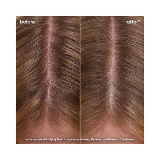Före och efter resultat av Biolage Scalp Sync Shampoo som visar förbättrad hårbottens klarhet och minskad torrhet efter en användning.