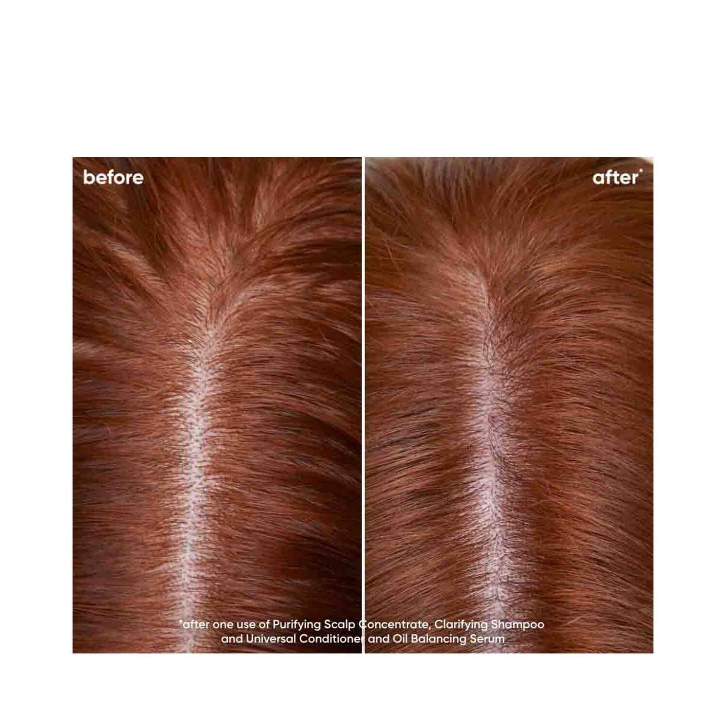 Before and after results of Biolage Scalp Sync Clarifying Shampoo showing reduced scalp oil and buildup after one use.