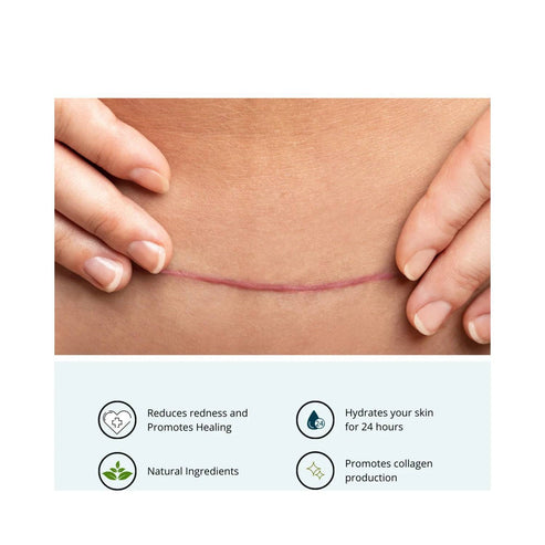 DermaMed Scar Balm