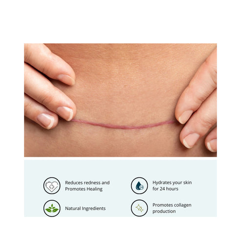 DermaMed Scar Balm
