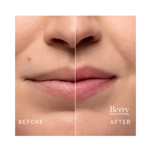 Before and after comparison of lips using Fresh Sugar Lip Treatment in Berry, showing enhanced hydration and tint.