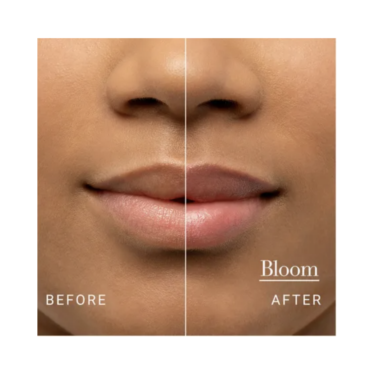 Before and after lips using Fresh Sugar Lip Treatment Bloom, highlighting improved moisture and natural tint.