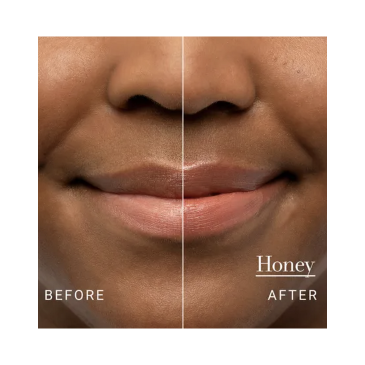 Before and after lips using Fresh Sugar Lip Treatment Honey, highlighting natural tint and moisture boost.