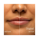 Before and after lips using Fresh Sugar Lip Treatment Original, showing improved hydration and natural shine.