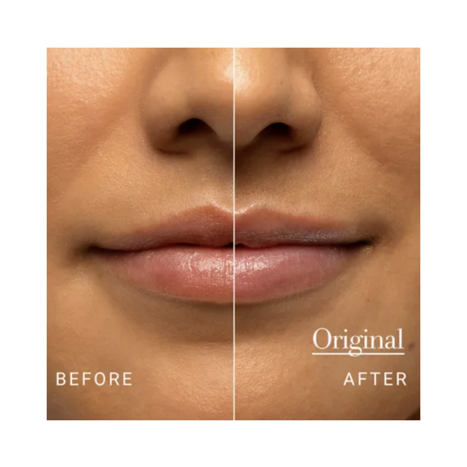 Before and after lips using Fresh Sugar Lip Treatment Original, showing improved hydration and natural shine.