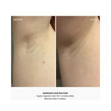Bushbalm Summer Vacay Ingrown Hair Oil
