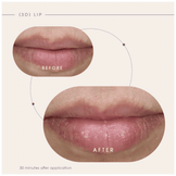 Teoxane [3D] Lip, Nourishing & Plumping Lip Care