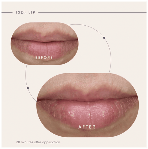 Teoxane [3D] Lip, Nourishing & Plumping Lip Care