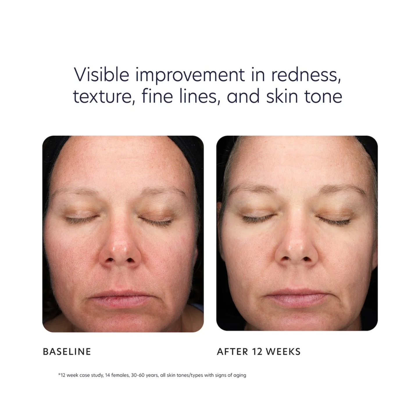 PCA Skin Triple Exfoliation Peel Pads