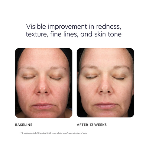 PCA Skin Triple Exfoliation Peel Pads