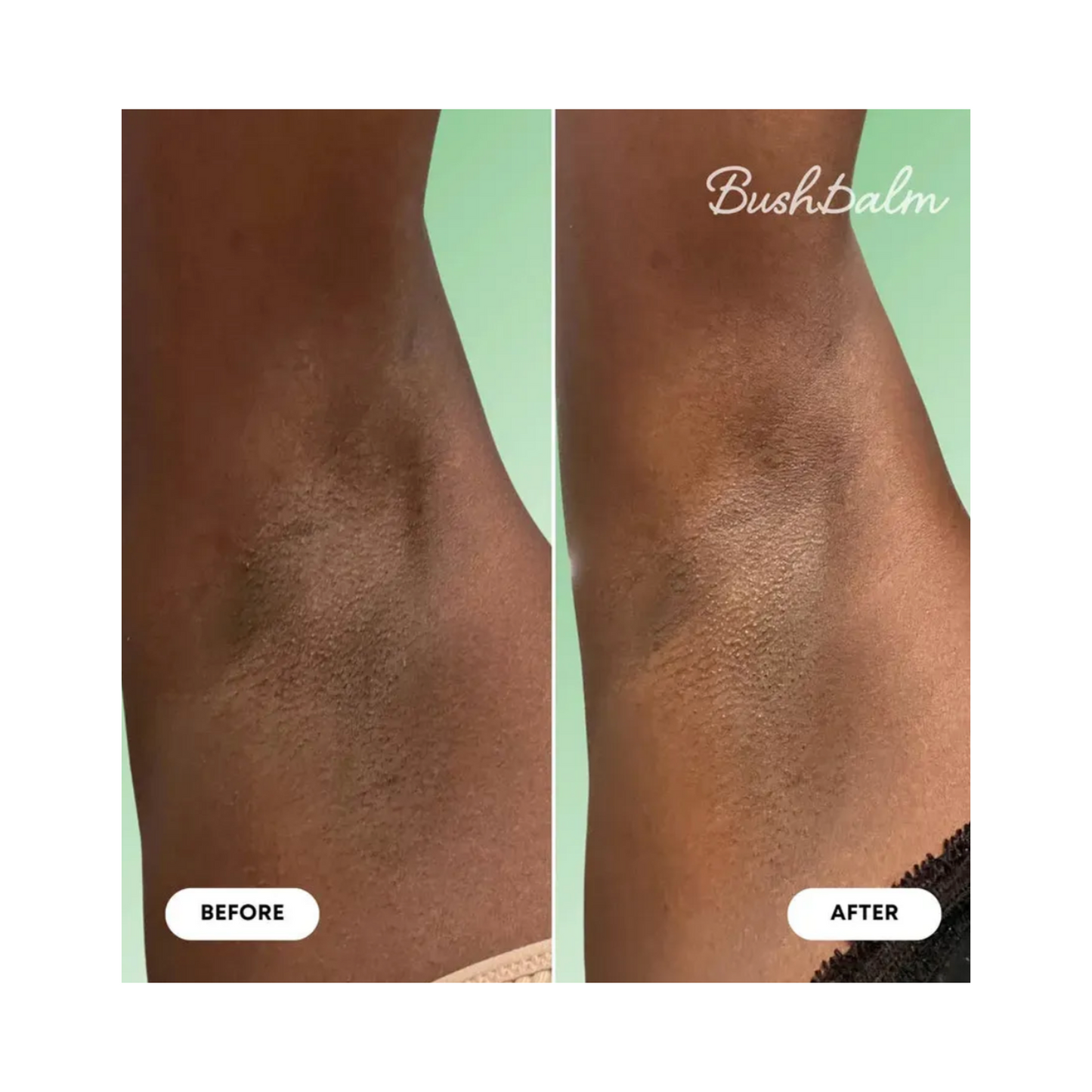 Bushbalm Wild Mint and Lemon Oil Dark Spot