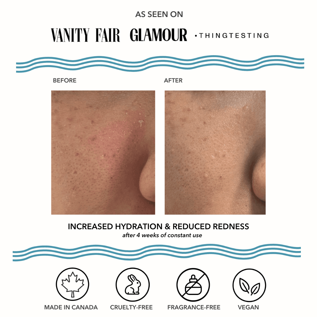 Vacation Skin Redness Recovery Overnight Mask and Moisturizer