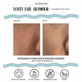 Vacation Skin Redness Recovery Overnight Mask and Moisturizer