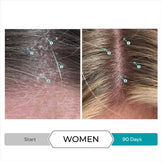Dandrene Anti-Dandruff Conditioner